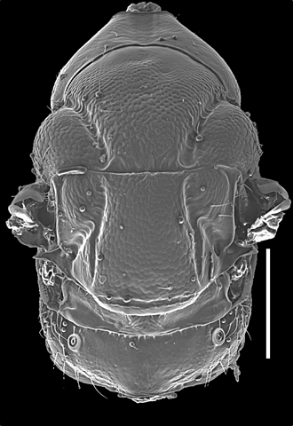 Anidarnes_brevior_mesosoma_SEM