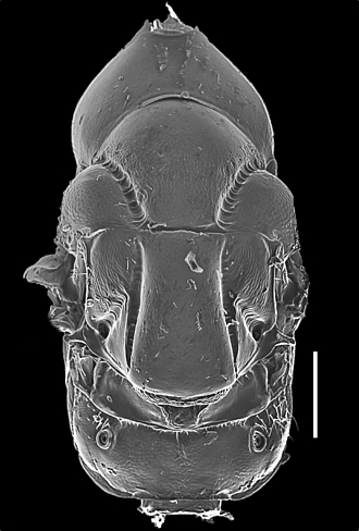 Anidarnes_gracile_mesosoma_SEM