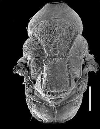 Anidarnes_niger_mesosoma_SEM